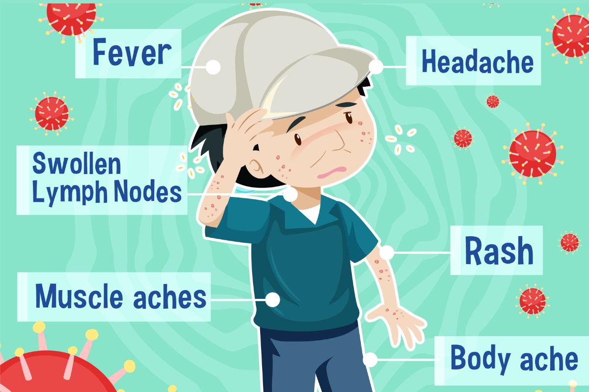 Gejala Cacar Monyet yang Perlu Diwaspadai