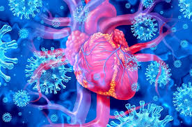 What Is Endocarditis ?